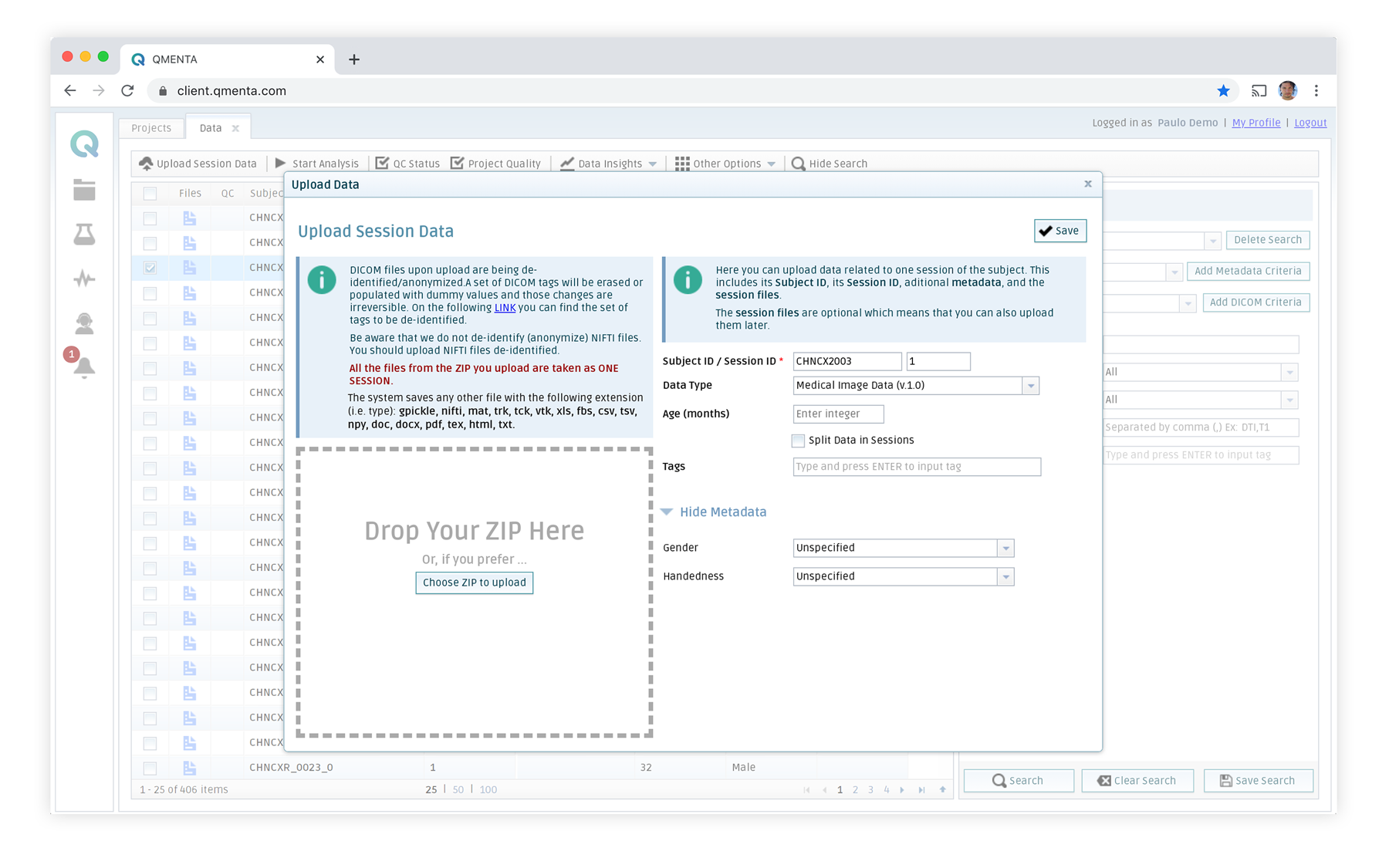 Screenshot of QMENTA platform for data upload