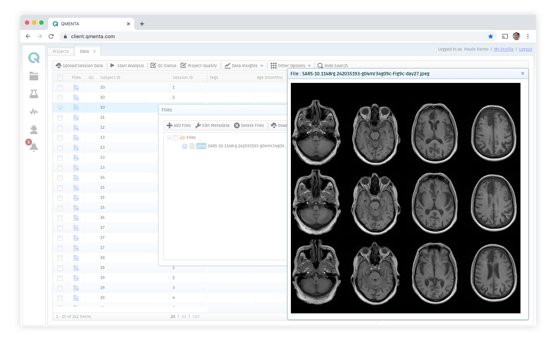 qmenta-platform-discover-stroke qmenta-platform-discover-stroke